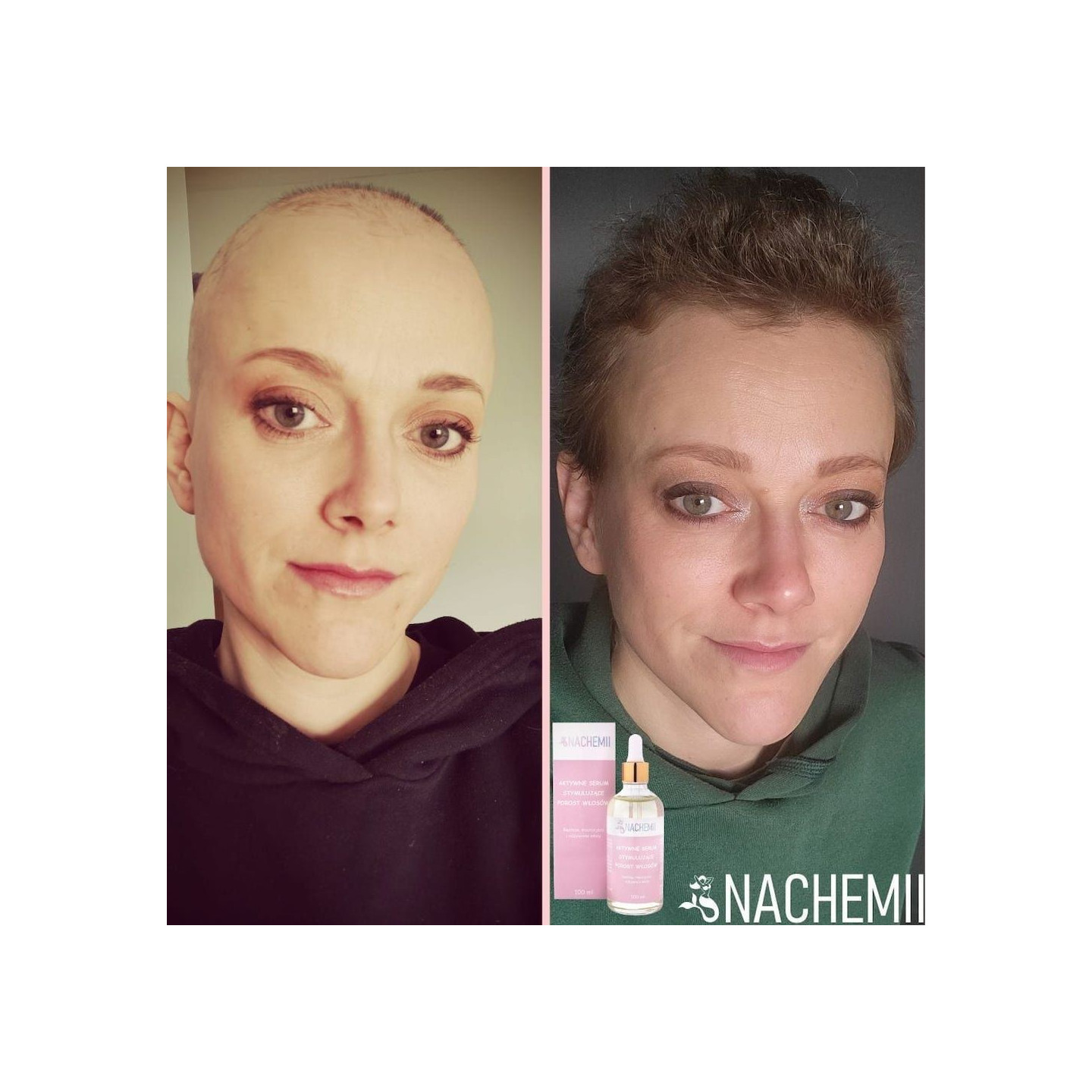 Serum stymulujące porost włosów